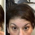 Covering All About Hair Fibers: Solutions for Hair Loss and Baldness