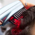 Low-Level Laser Therapy (LLLT) for Hair Loss: Solutions and Treatments