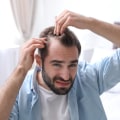 Exercise and Physical Activity: How to Manage Stress and Prevent Hair Loss