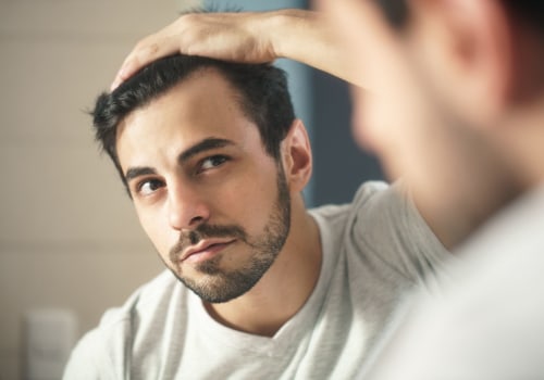 Effective Time Management Tips for Preventing Baldness and Hair Loss