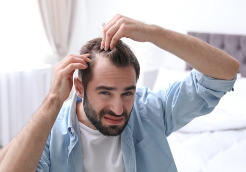 Exercise and Physical Activity: How to Manage Stress and Prevent Hair Loss